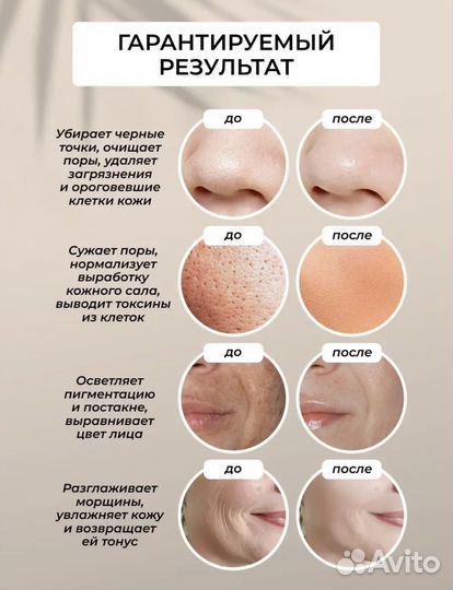 Ультразвуковой аппарат для чистки лица