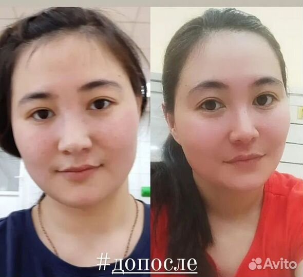 От отёков, лифтинг эффект