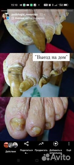 Подолог(решение проблем), педикюр