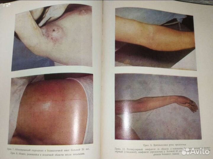 Гнойно септич хирургия. София Болгария 1971/74г