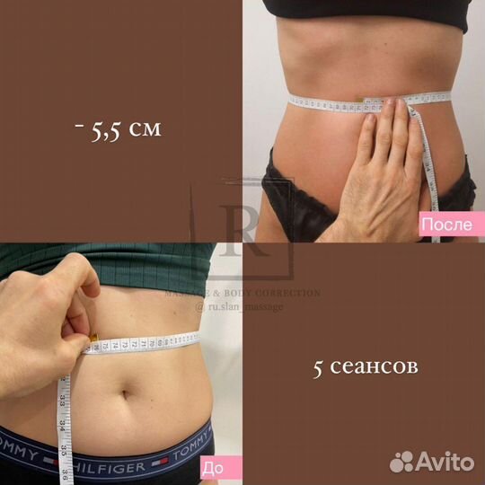 Массаж Моделирование фигуры