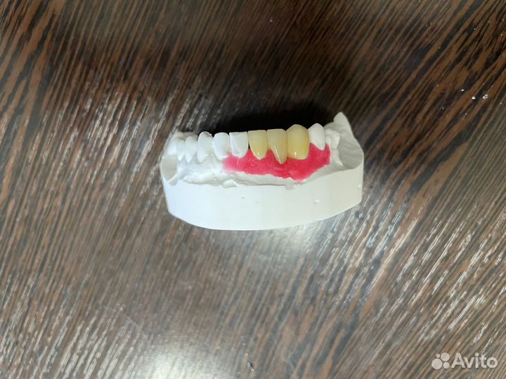 Услуги зубного техника