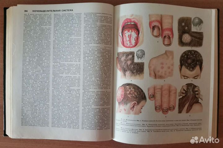 Медицинская энциклопедия СССР 1980