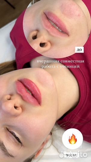 Обучение косметологии