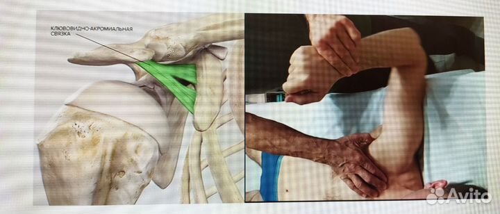Массаж на дому / на выезд