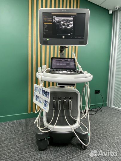 Ультразвуковая система Philips Affinity 70