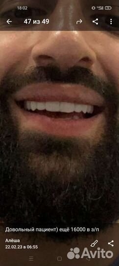 Съёмные/зубные протезы,коронки на зуб