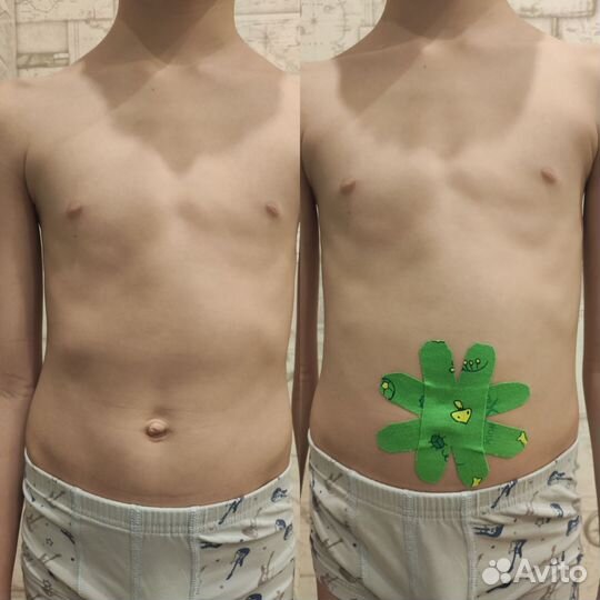 Детский массаж