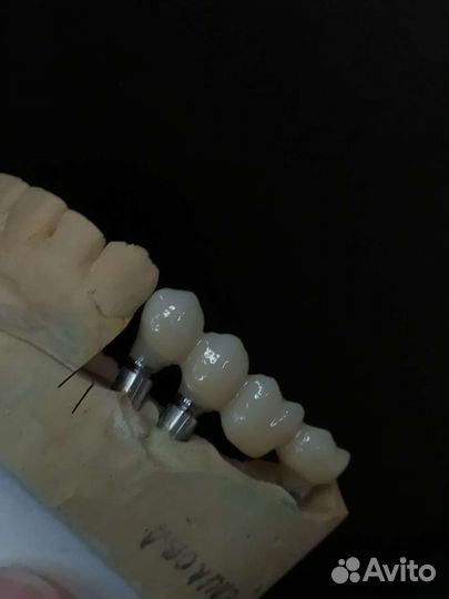 Зубной техник