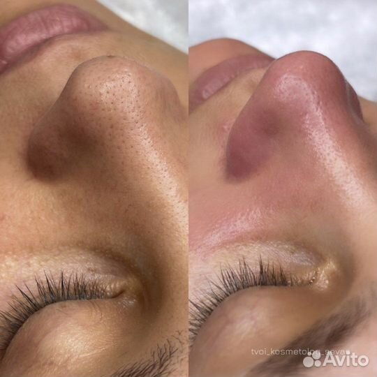 Консультация косметолога