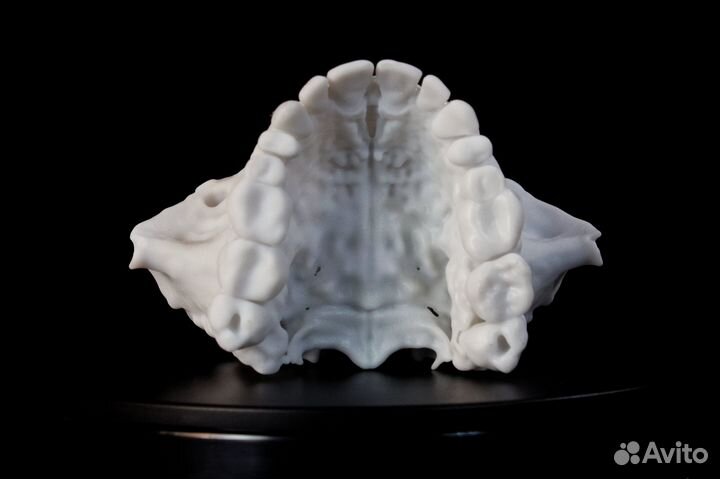 Анатомическая модель верхней челюсти