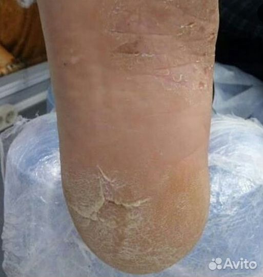 Маникюр Педикюр