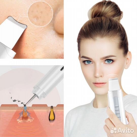 Ультразвуковой очиститель для лица