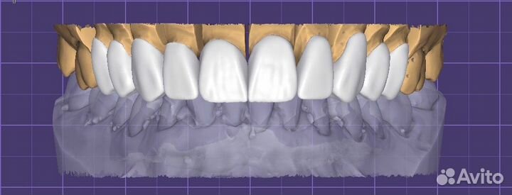 Зубной техник cad Cam