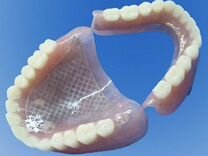 Изготовление микропротезов,съемные зубные протезы