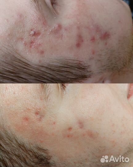 Услуги косметолога