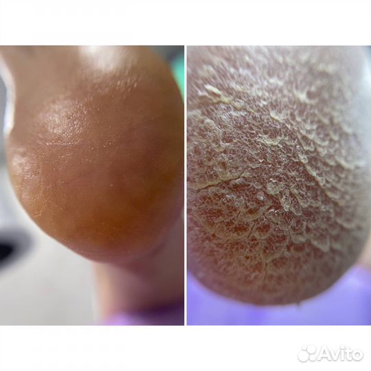 Подолог, мастер педикюра