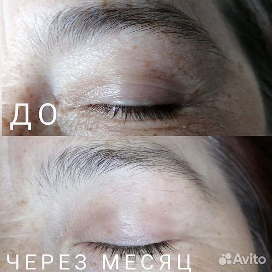 Аппаратная косметология