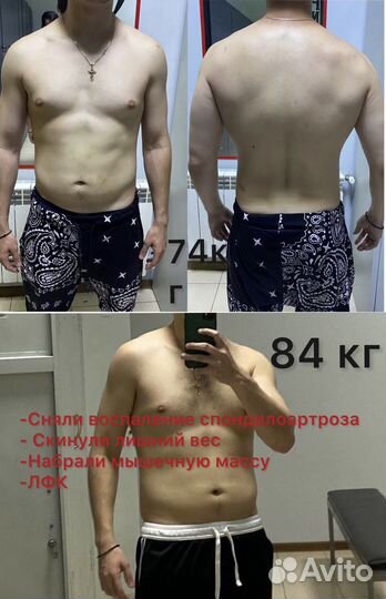 Костоправ (лфк)