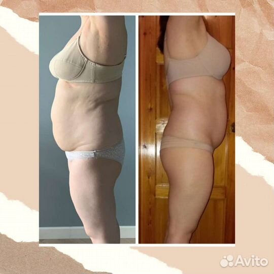 Антицеллюлитный массаж