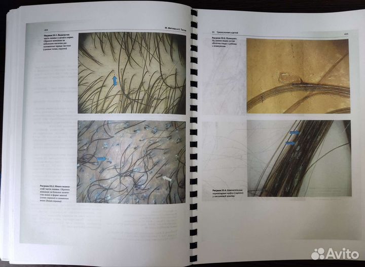 Атлас трихоскопии