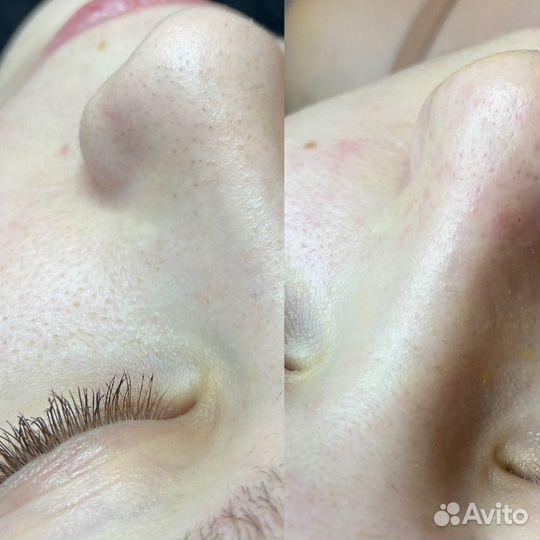 Услуги косметолога