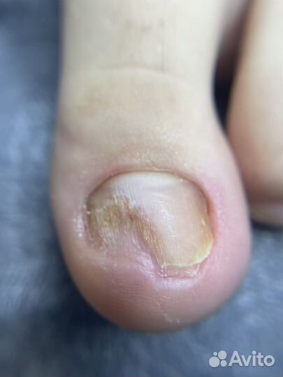 Аппаратный маникюр