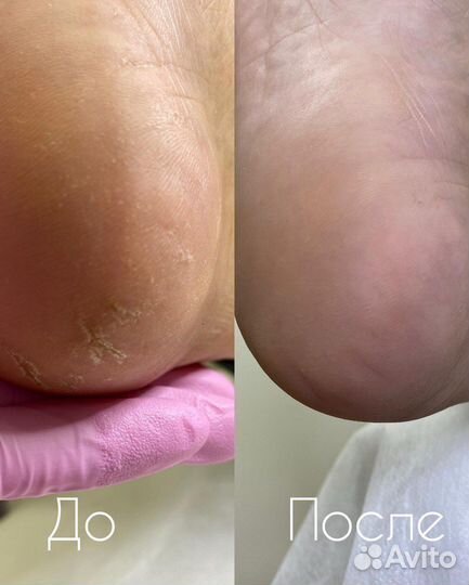 Услуги мастера педикюра, подолог