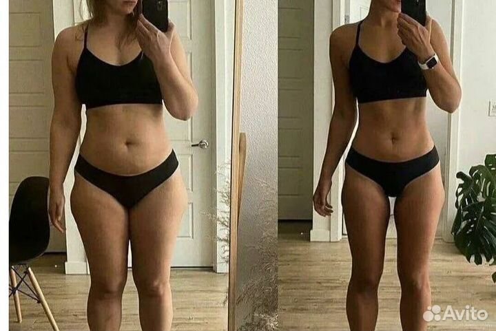 Удаление жира, криолиполиз в Курске