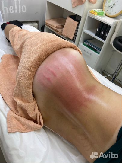 Безоперационно выравниваю линию талии, убираю бока