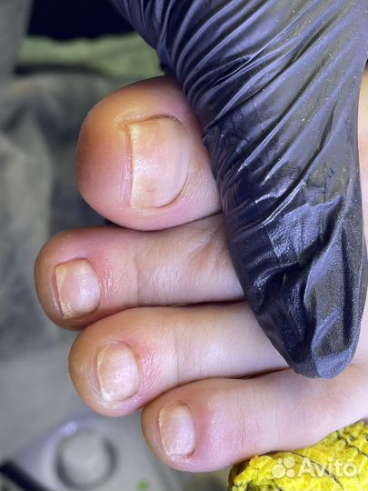 Педикюр подолог