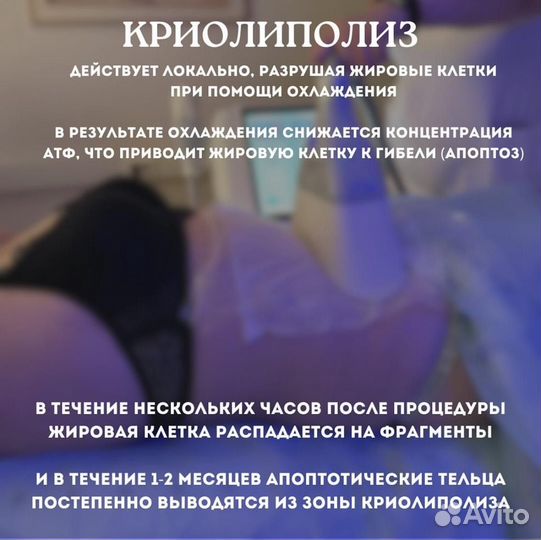 Криолиполиз Кавитация РФ Лифтинг