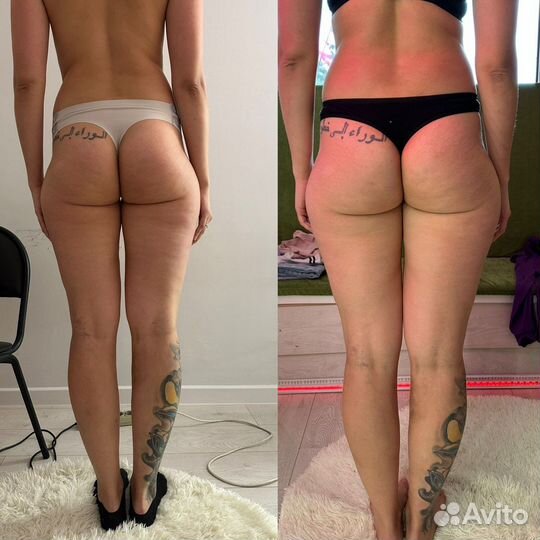 Lpg массаж Кавитация Pf лифтинг тело/лицо