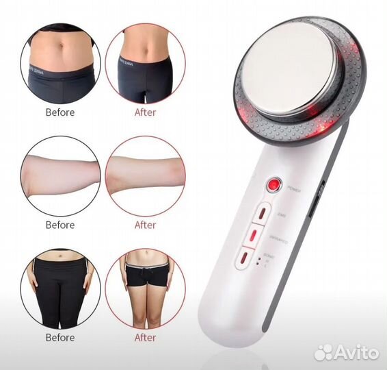 Массажер ультразвуковой 1Мгц