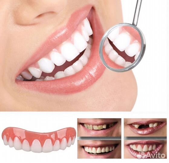 Виниры для зубов perfect smile