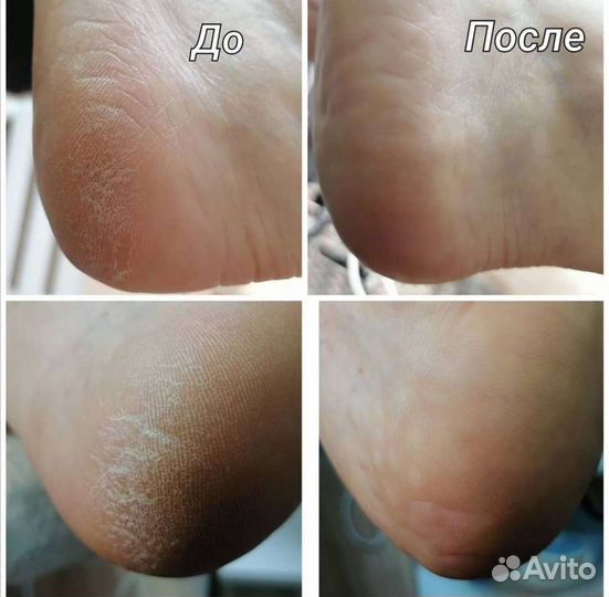 Маникюр, педикюр, укрепление ногтей, наращивание