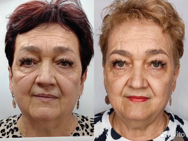 Косметические услуги