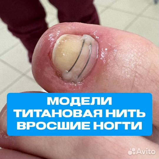 Модель к подологу