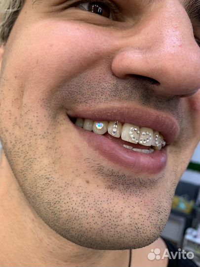 Отбеливающие полоски для зубов скайсы казань