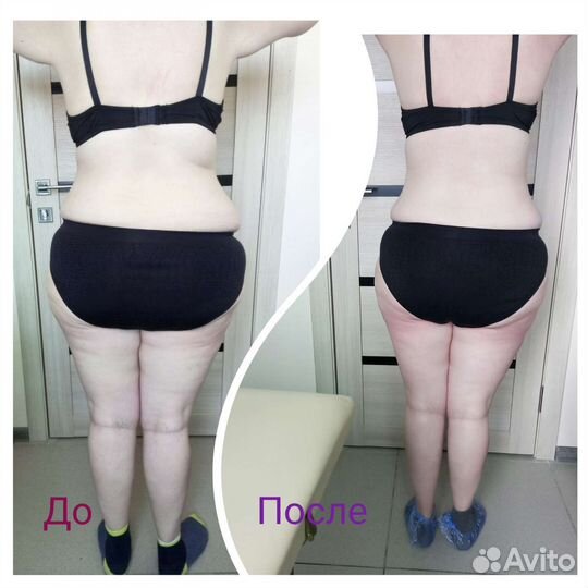 Аппаратный массаж