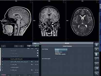 Мрт томограф siemens magnetom avanto 1.5T