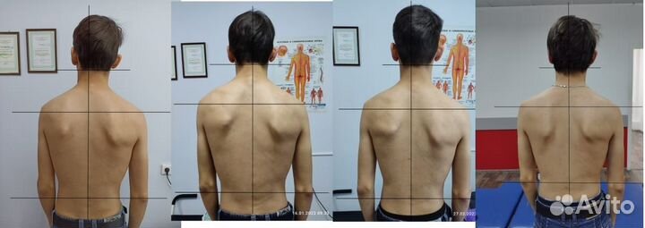 Правка Атланта atlasprofessional