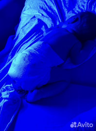 Фотолампа от желтушки