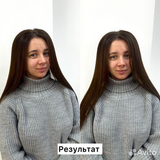 Обучение на Прикорневой Объём