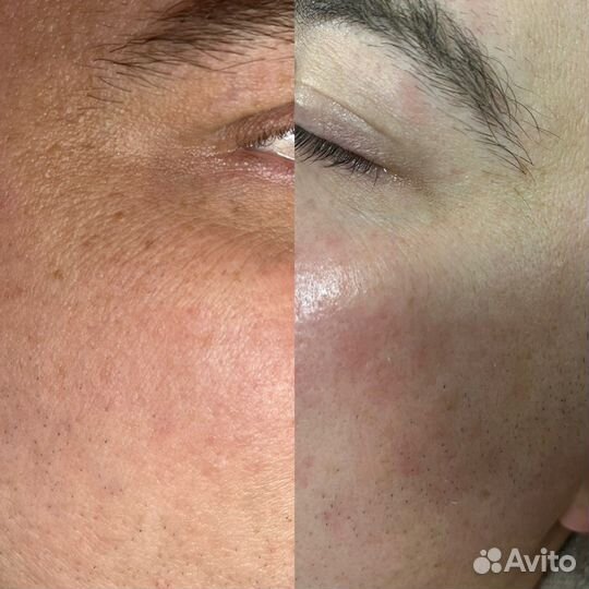 Обучение косметик-эстетист