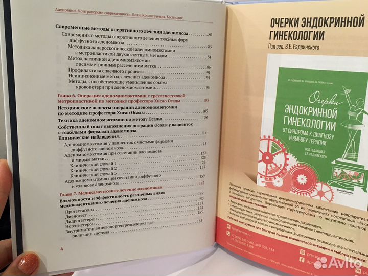 Аденомиоз. Контроль версий современности. Цхай