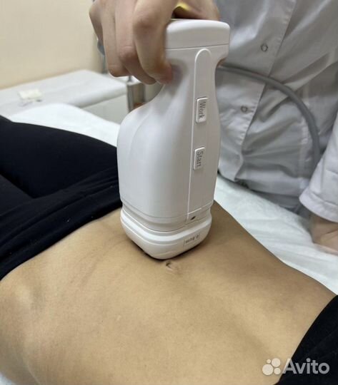 Коррекция фигуры Liposonic / Похудение без диет