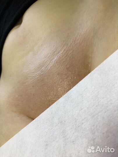 Депиляция воском