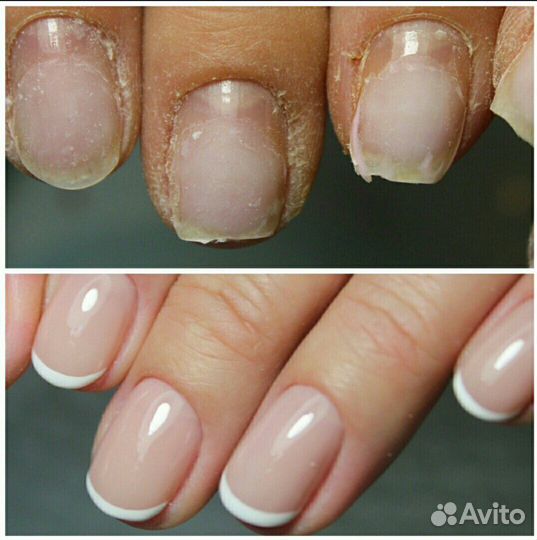 Маникюр педикюр наращивание шугаринг