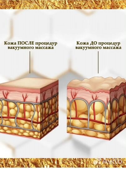 Массажер электрический